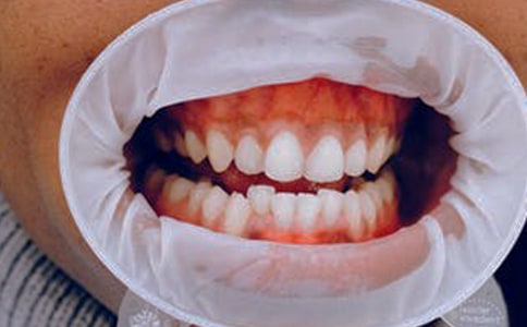 ��ǻ��(zh��)�I(y��)�����t(y��)�����c(di��n)���������l�R�������f��