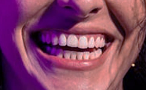 ���l�[ʹ��ô�k