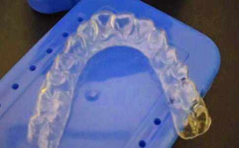 牙套相伴滋味長(zhǎng)初一作文750字