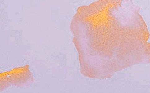 ���P(gu��n)�W(xu��)ˇ�g(sh��)������