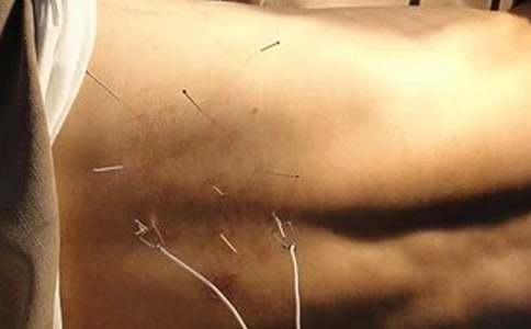 2017���t(y��)��(zh��)�I(y��)�t(y��)��ᘾČW(xu��)���c(di��n)����̫ꖰ��׽�(j��ng)Ѩ